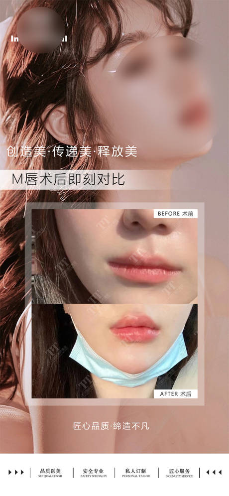 源文件下载【享设计】搜索编号：24810022079785276【医美案例对比海报】