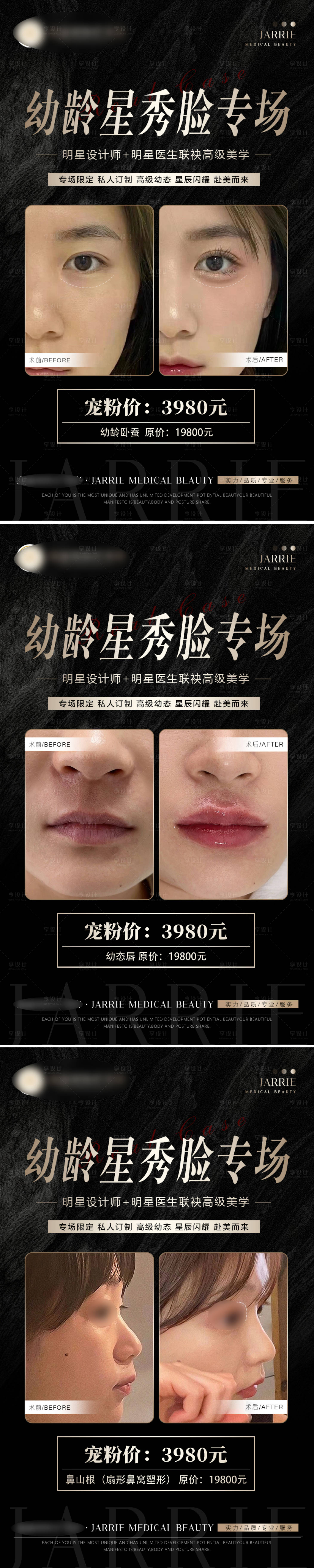 源文件下载【享设计】搜索编号：21670021981221634【整形案例海报】