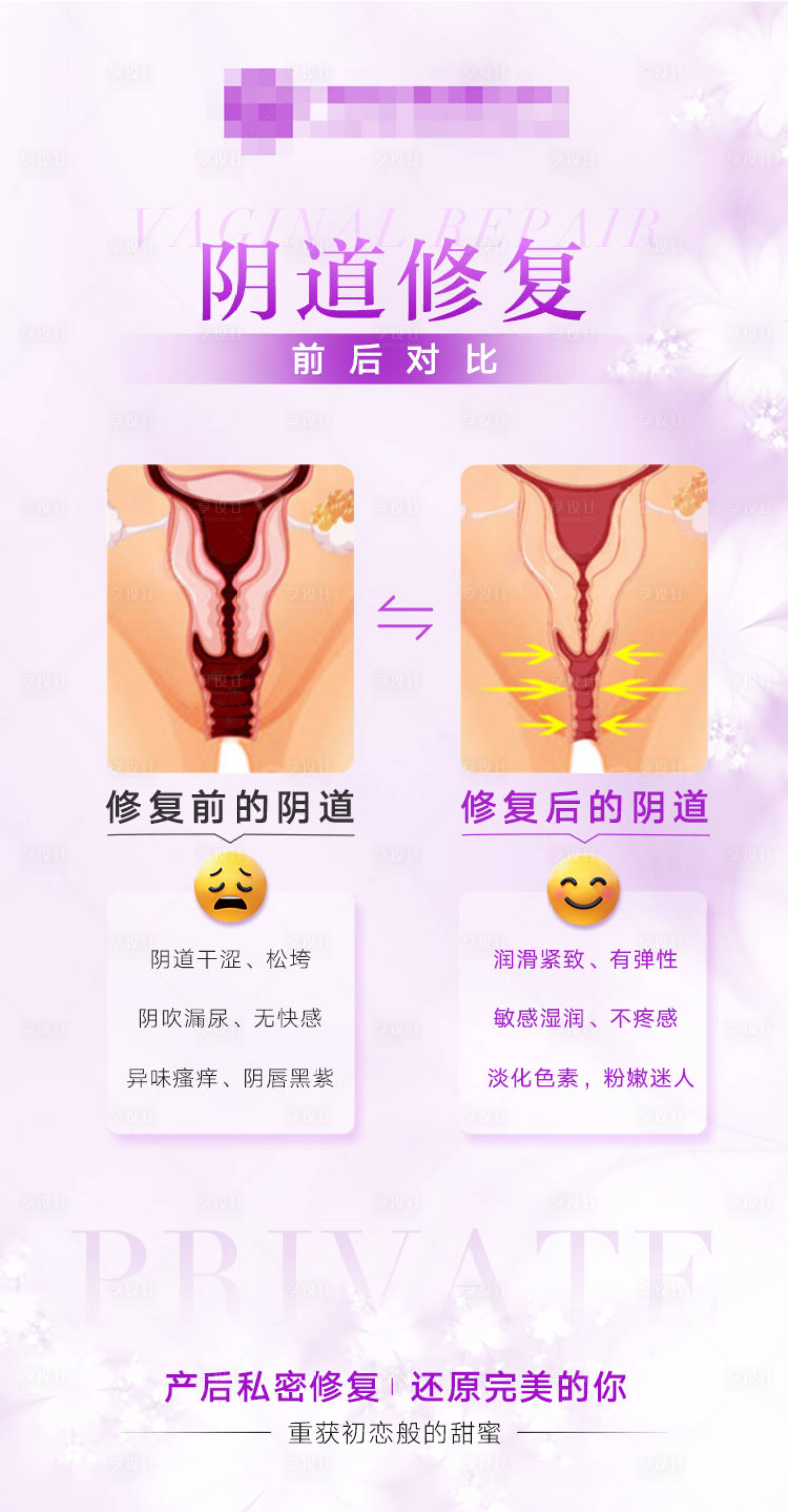 源文件下载【享设计】搜索编号：19580021909987943【医美私密保养海报】