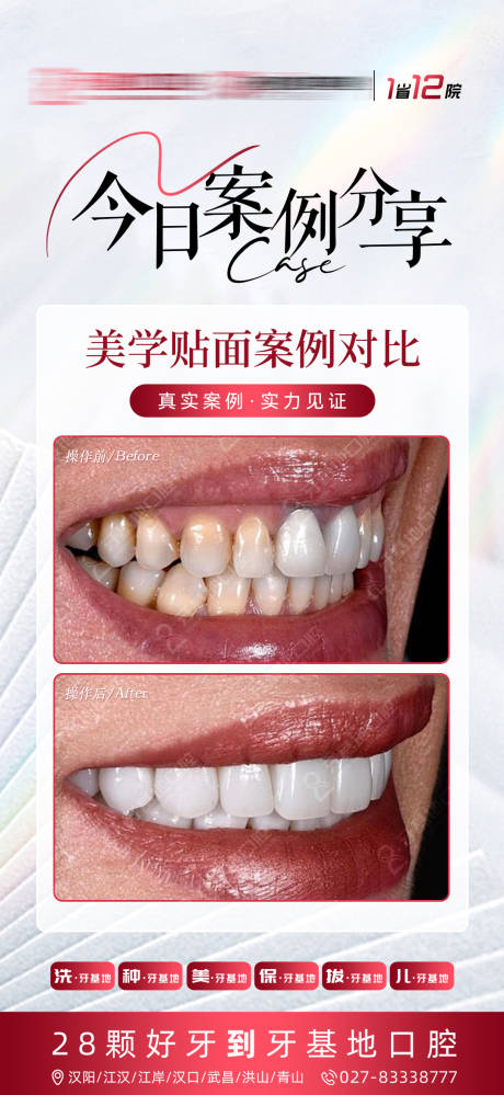 源文件下载【口腔案例海报】编号：13330021981487668