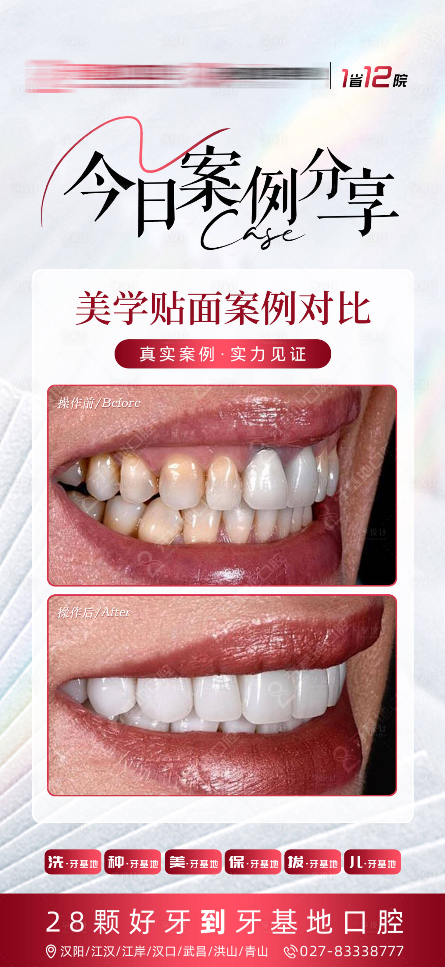 源文件下载【享设计】搜索编号：13330021981487668【口腔案例海报】