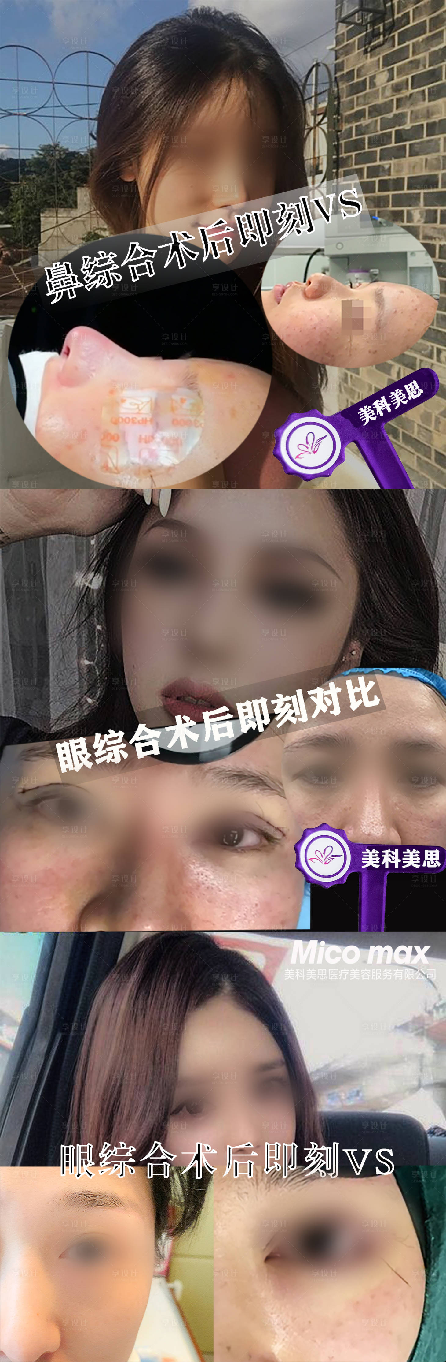 源文件下载【享设计】搜索编号：43180022072322804【医美案例对比海报】