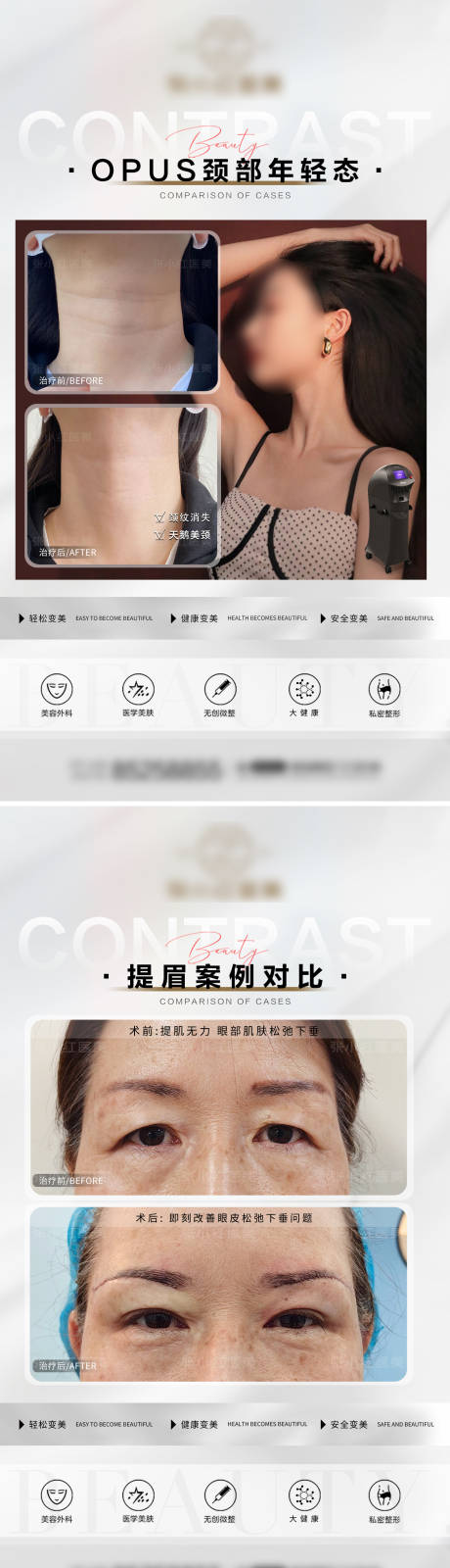 源文件下載【整形案例海報】編號：33080021969158774