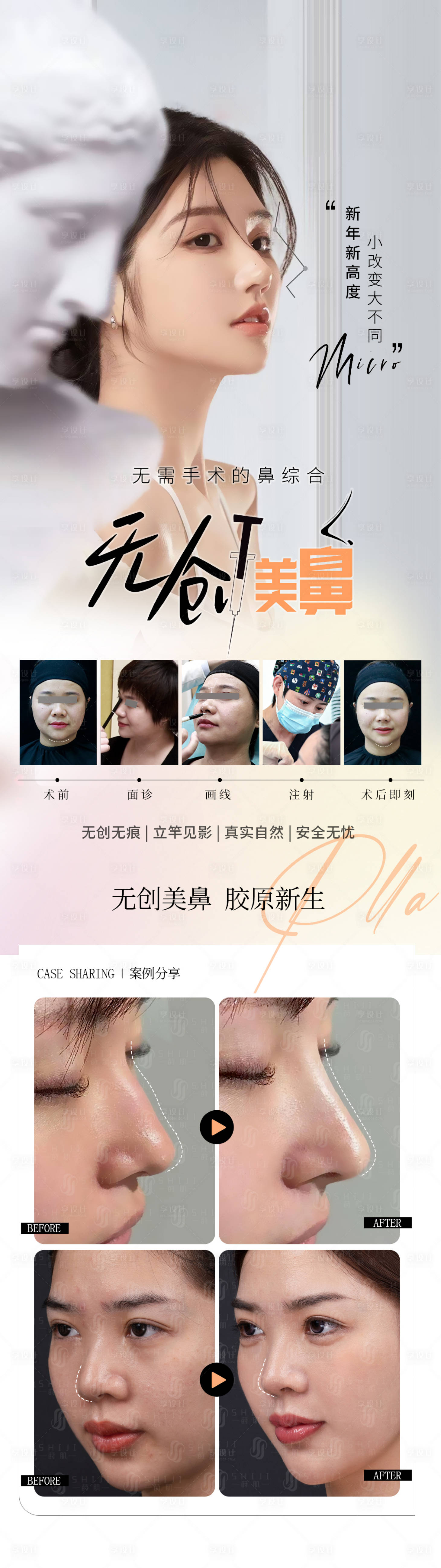 源文件下载【医美玻尿酸填充鼻子海报】编号：43610022086796366