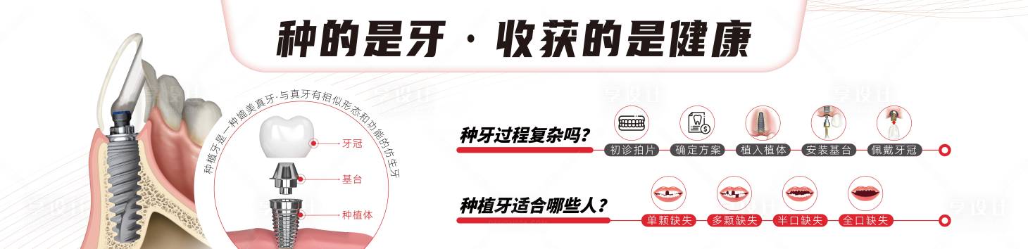源文件下載【享設計】搜索編號：36240022086356175【口腔種植牙海報展架】