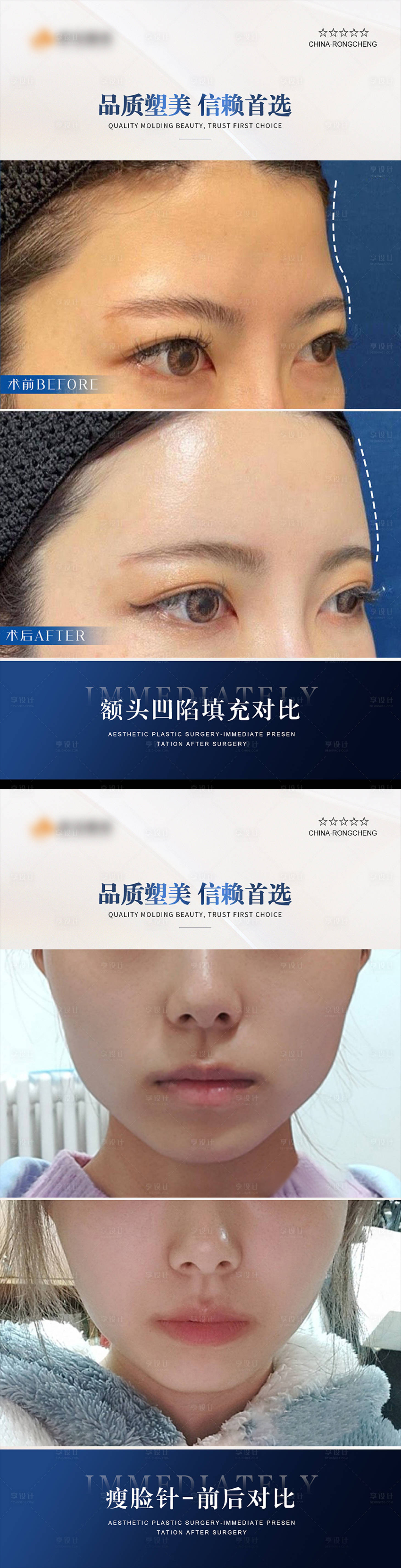 源文件下载【享设计】搜索编号：65570021894381945【医美案例对比模版海报】