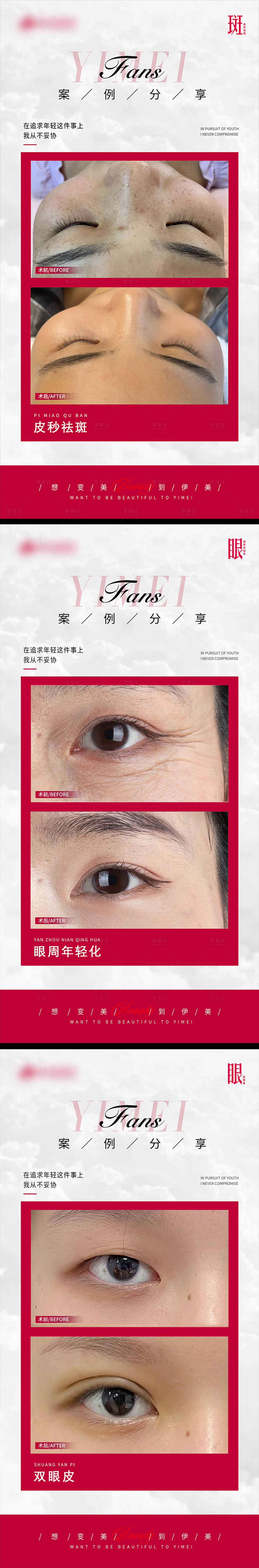 源文件下载【享设计】搜索编号：31680021955628140【医美海报】