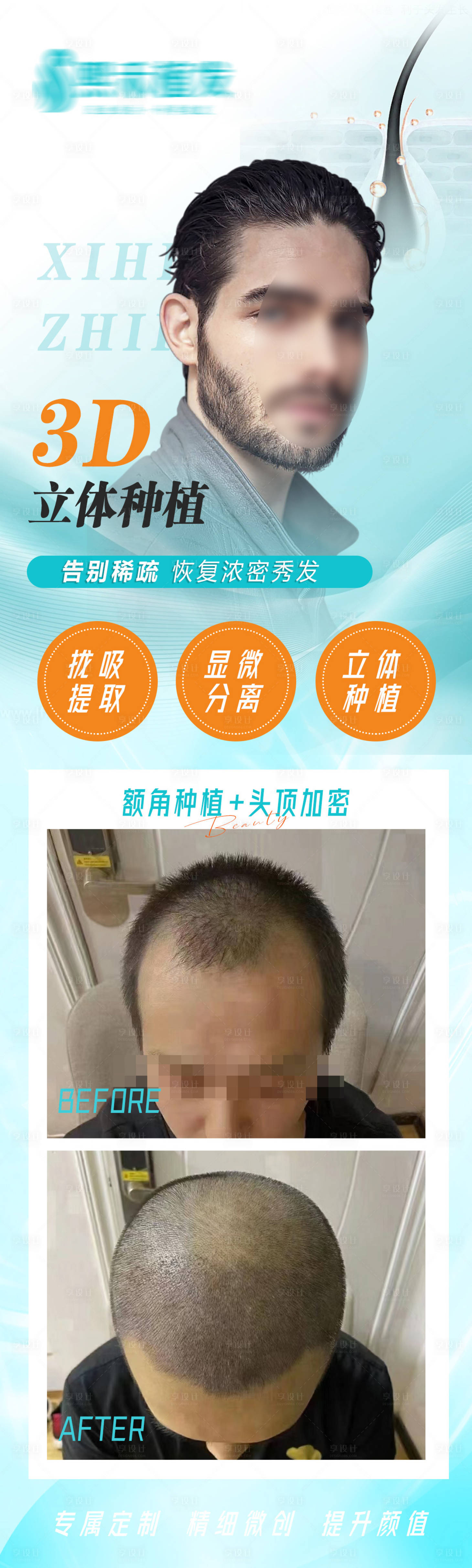 源文件下載【享設計】搜索編號：13740022203567601【3D立體種植植發長圖海報】