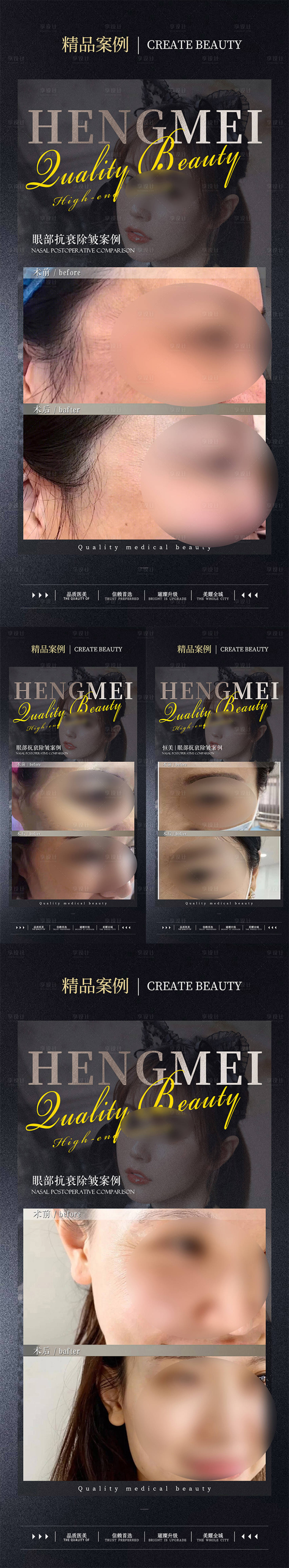 源文件下載【享設(shè)計(jì)】搜索編號(hào)：56160022070044506【醫(yī)美案例對(duì)比系列海報(bào)】