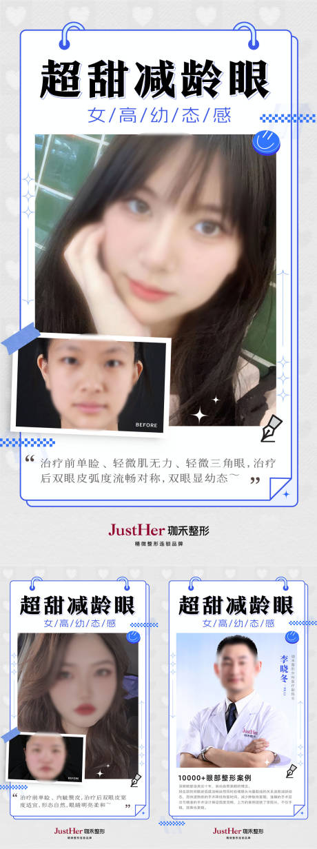 源文件下载【双眼皮案例对比海报】编号：90610021871913720