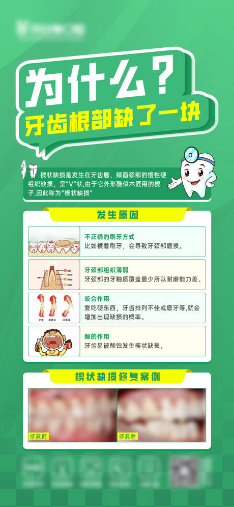 源文件下载【牙齿楔状缺损科普案例海报】编号：17200021849402121