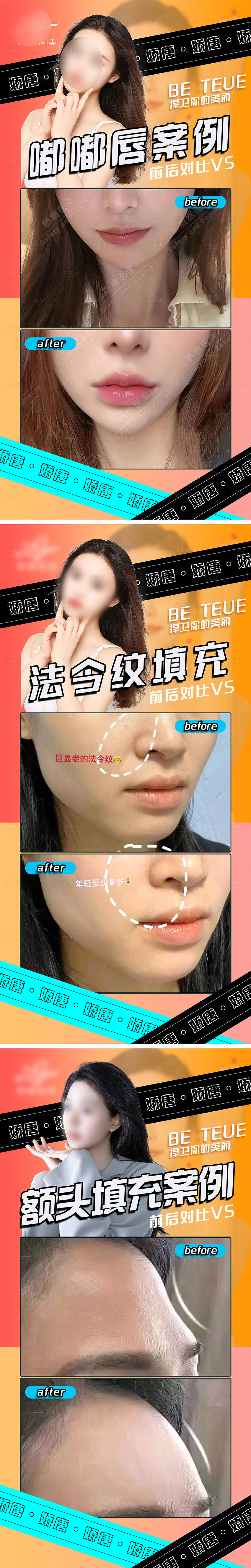 源文件下载【享设计】搜索编号：89660022078387326【医美对比案例】