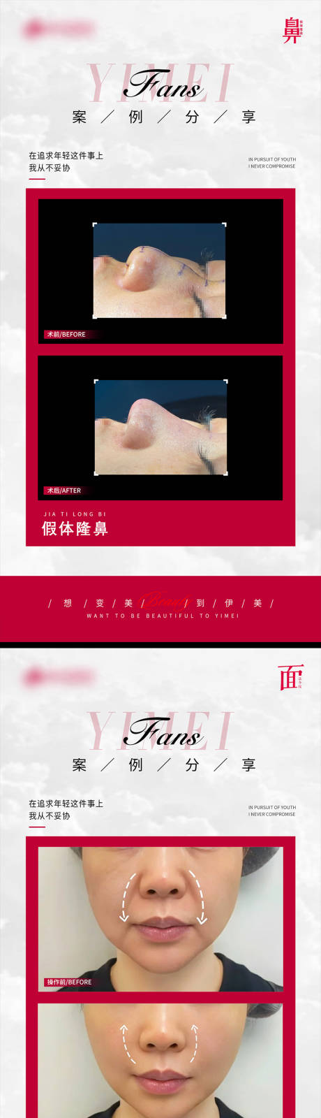 源文件下載【享設計】搜索編號：21060021954613942【醫美案例對比模版】