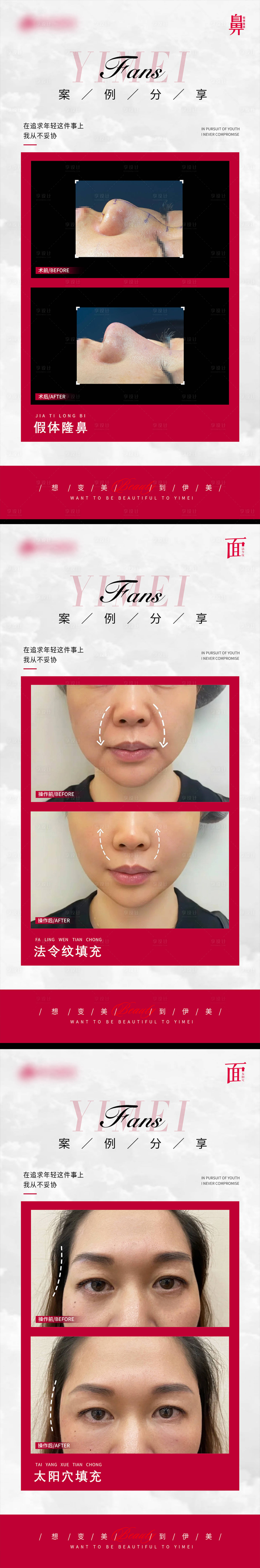 源文件下载【享设计】搜索编号：21060021954613942【医美案例对比模版】