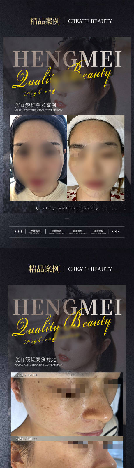源文件下載【醫美整形案例對比系列海報】編號：28840022067377058