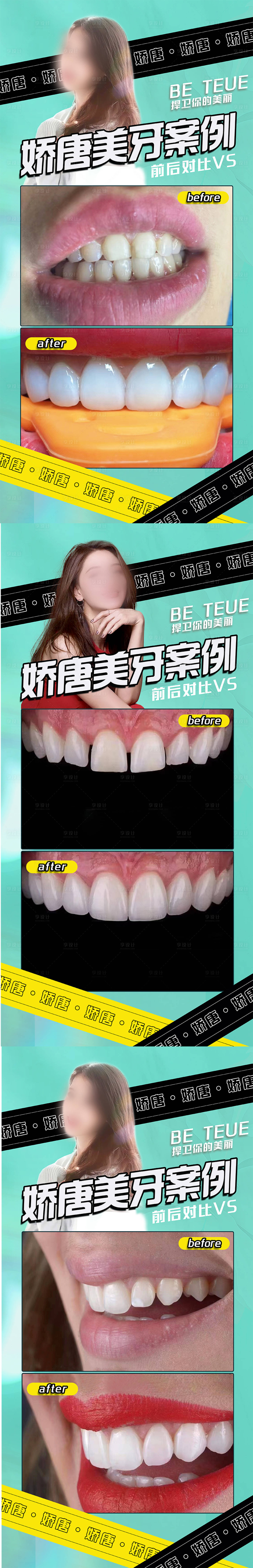 源文件下載【享設計】搜索編號：94480022078628817【醫美牙齒美容案例】