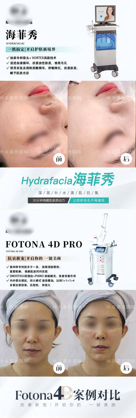 源文件下载【整形案例模板海报】编号：72900022097747289