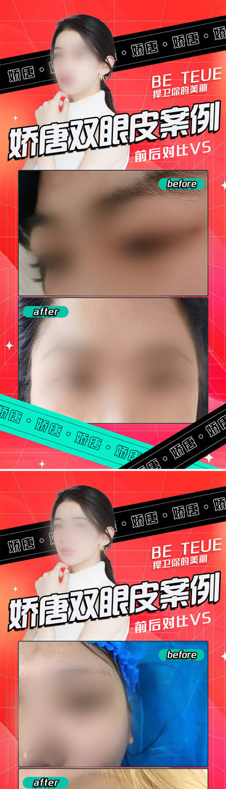 源文件下载【医美案例展示】编号：17770022078511753