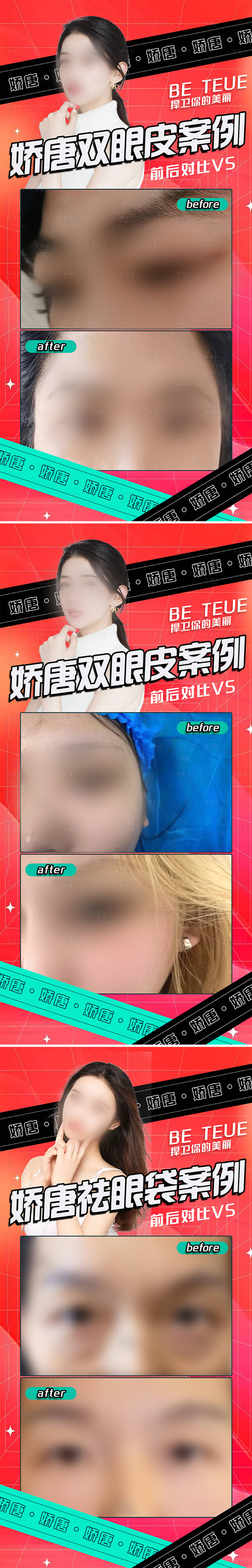 源文件下載【享設計】搜索編號：17770022078511753【醫美案例展示】