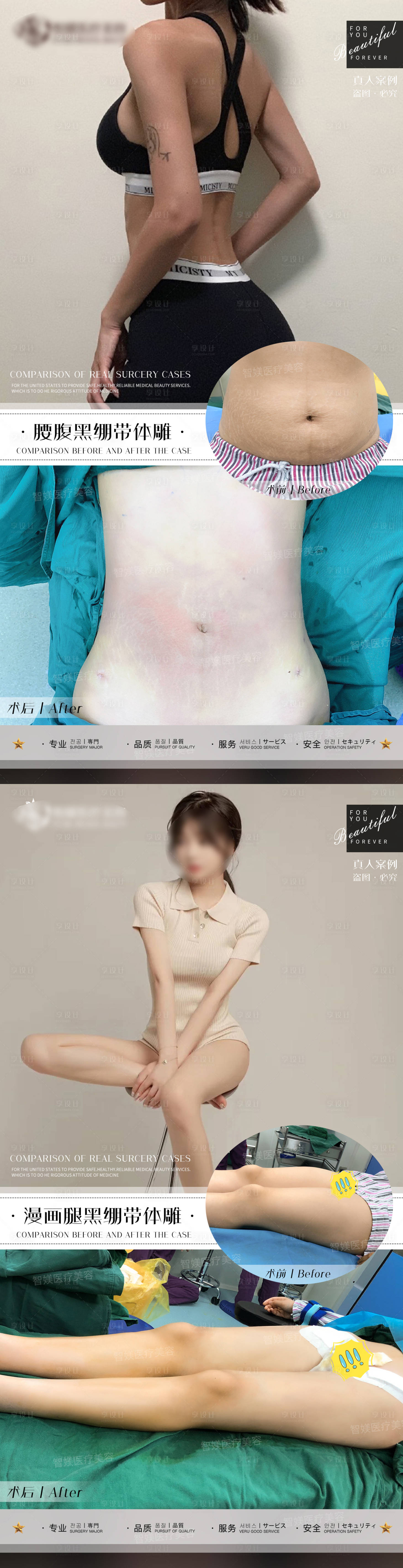源文件下载【享设计】搜索编号：51620021977855229【整形案例海报】