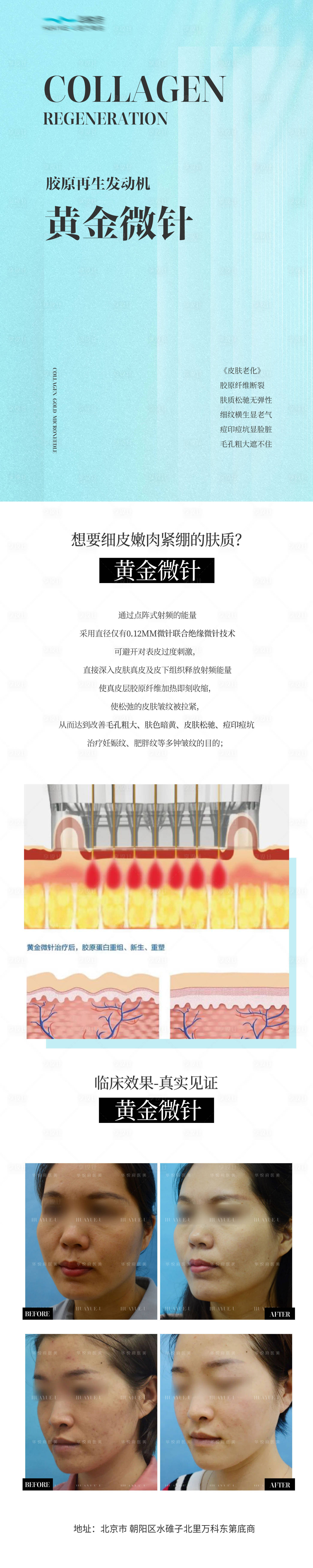 源文件下載【享設(shè)計】搜索編號：99110021916555959【黃金微針原理海報 】