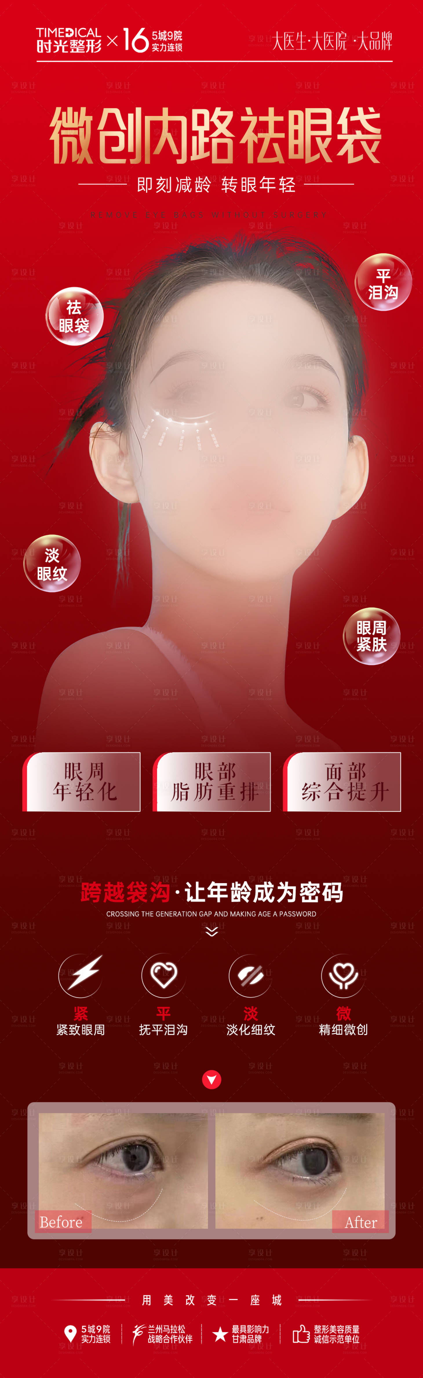 源文件下載【享設計】搜索編號：20930022115197026【微創內路祛眼袋】