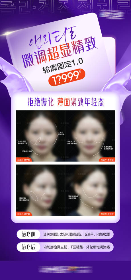 源文件下載【享設計】搜索編號：25790021976204712【醫美輪廓固定案例海報】