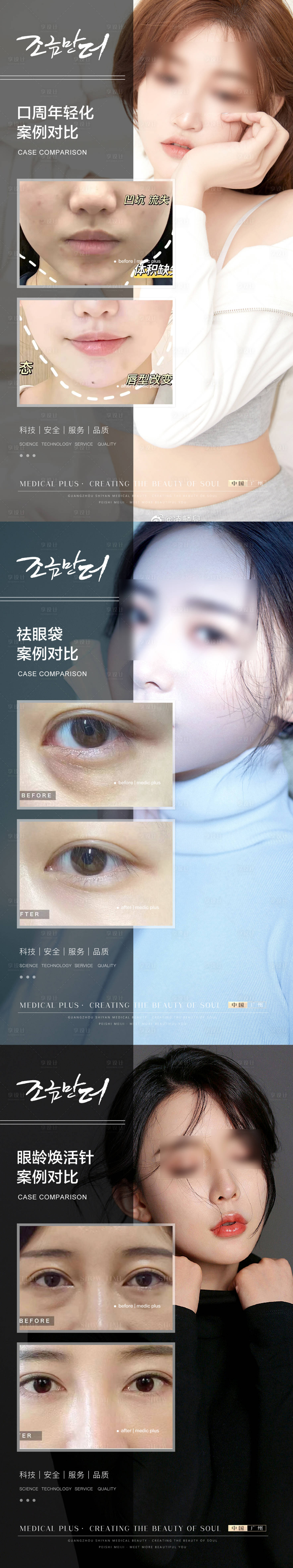 源文件下載【享設計】搜索編號：37840021849969774【醫美美容案例對比】