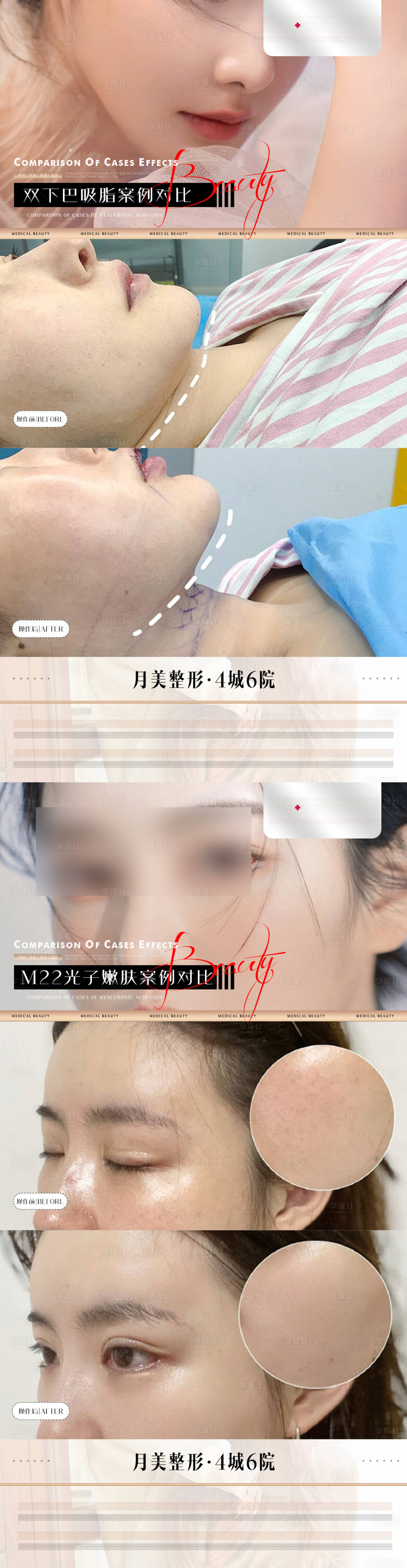 源文件下載【享設(shè)計】搜索編號：40830022062753765【整形輕奢案例海報】