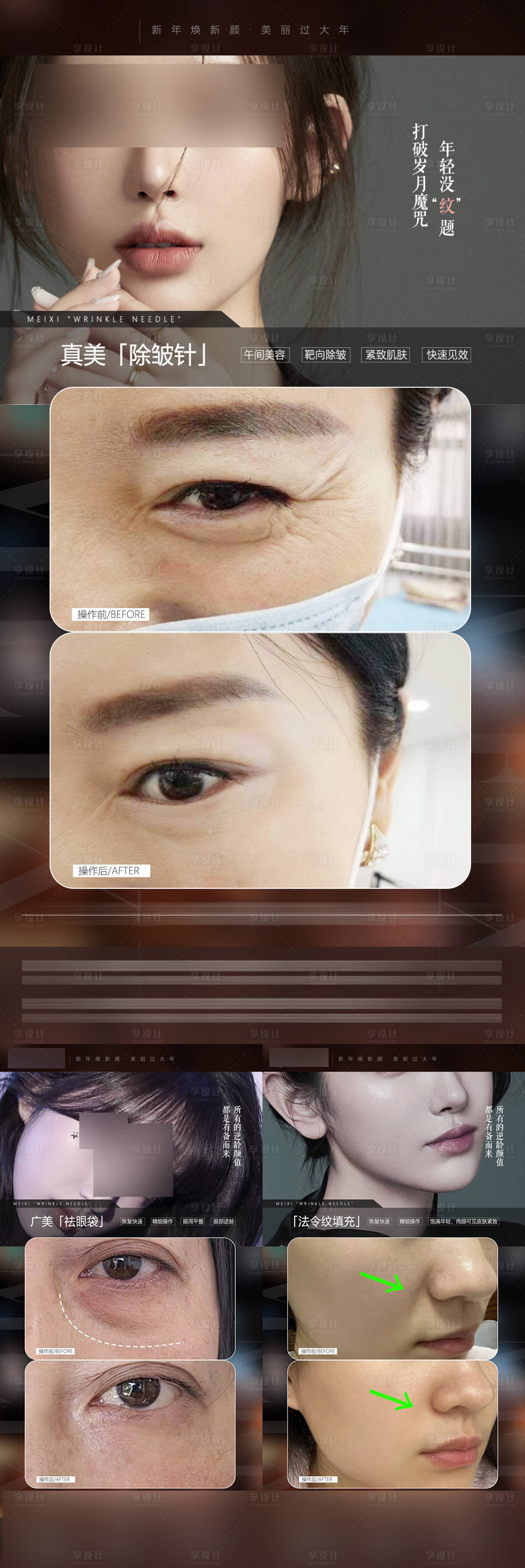 源文件下载【享设计】搜索编号：74920021973836449【医美案例对比模板海报】