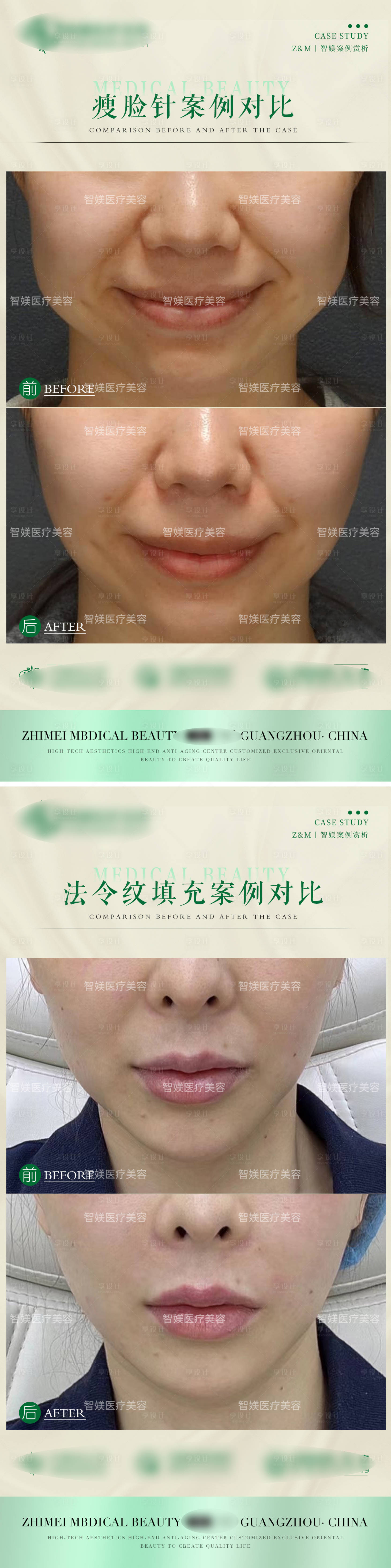 源文件下载【整形案例海报】编号：35240021978451158