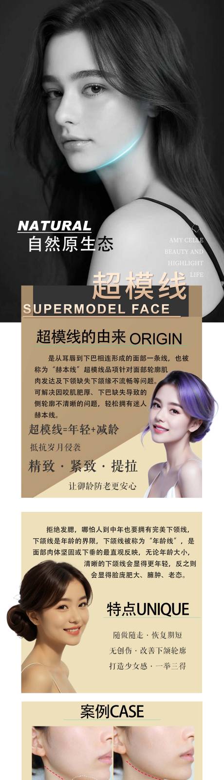 源文件下载【轮廓固定超模线】编号：58730021980213817