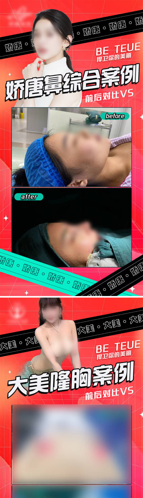 源文件下载【享设计】搜索编号：77010022084941961【医美案例对比系列海报】