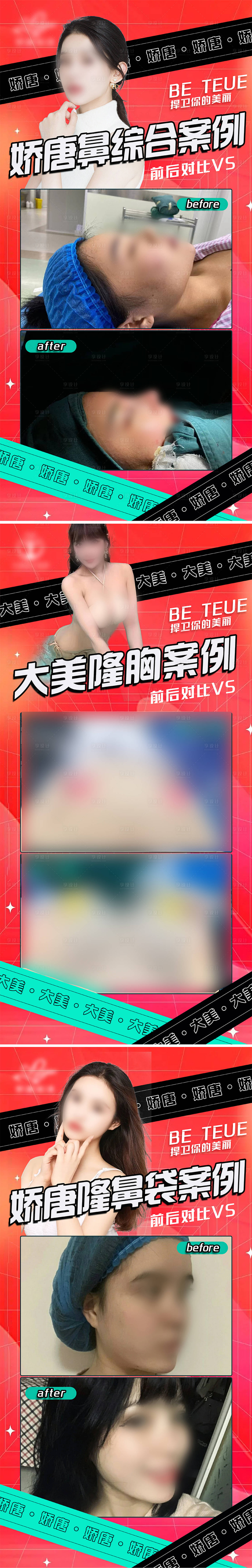 源文件下載【享設(shè)計(jì)】搜索編號(hào)：77010022084941961【醫(yī)美案例對(duì)比系列海報(bào)】