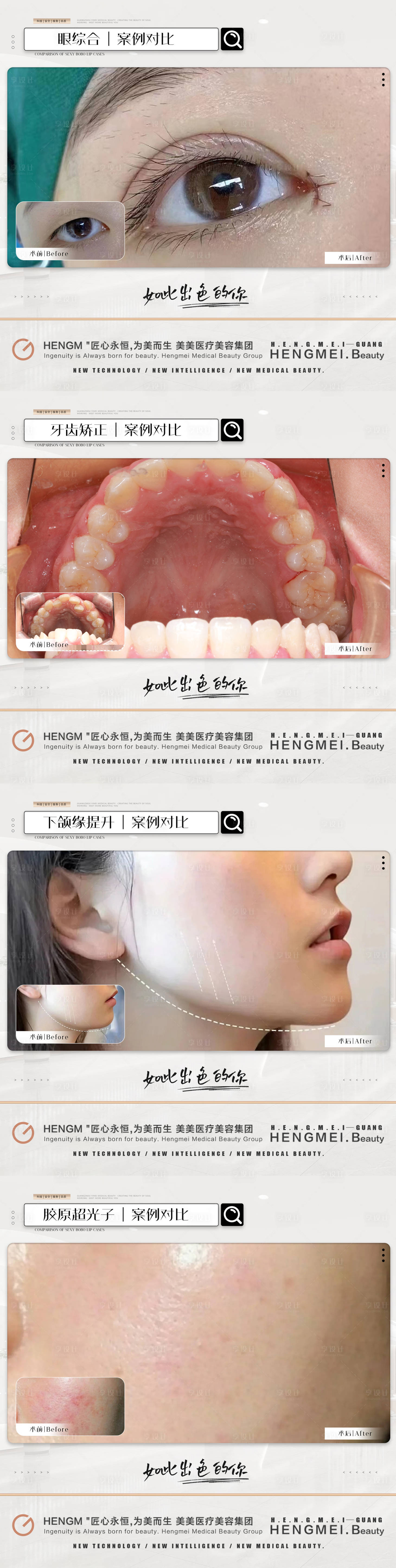 源文件下载【享设计】搜索编号：77310022130259982【医美整形案例简约系列海报】