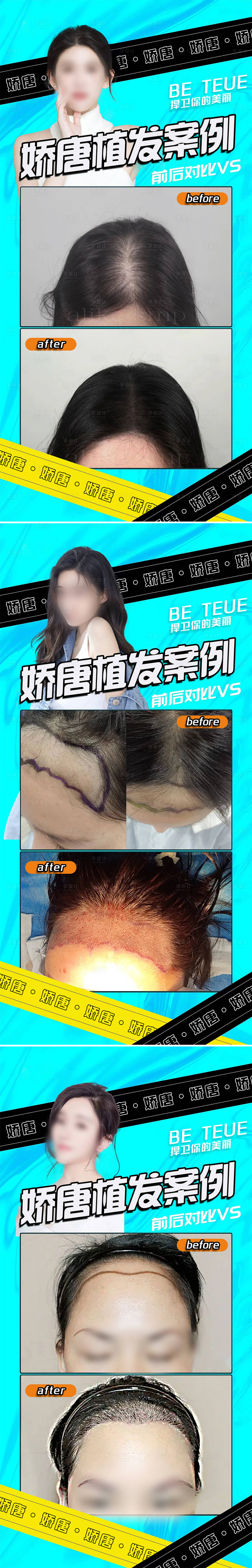 源文件下載【享設計】搜索編號：12740022078541147【醫美植發案例】