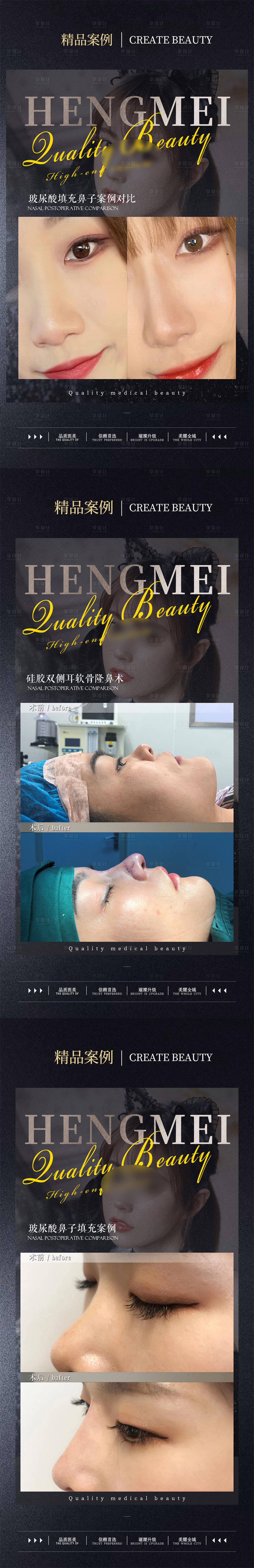 源文件下載【享設計】搜索編號：46140022066967229【醫美整形案例對比海報】