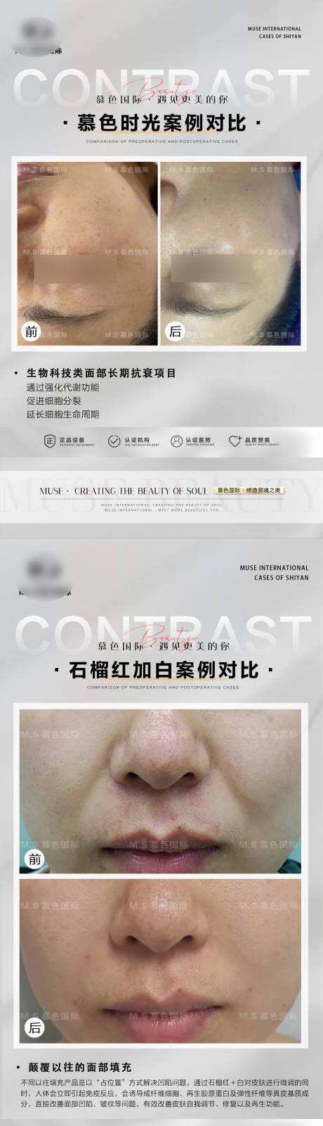 源文件下载【整形案例模板海报】编号：59430022097773763