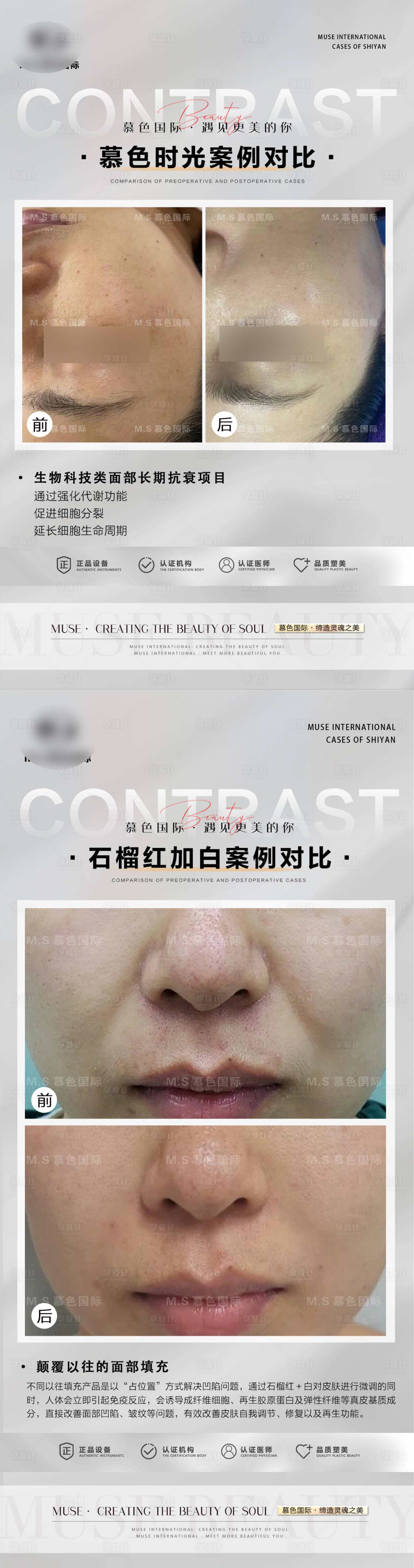 源文件下載【享設計】搜索編號：59430022097773763【整形案例模板海報】