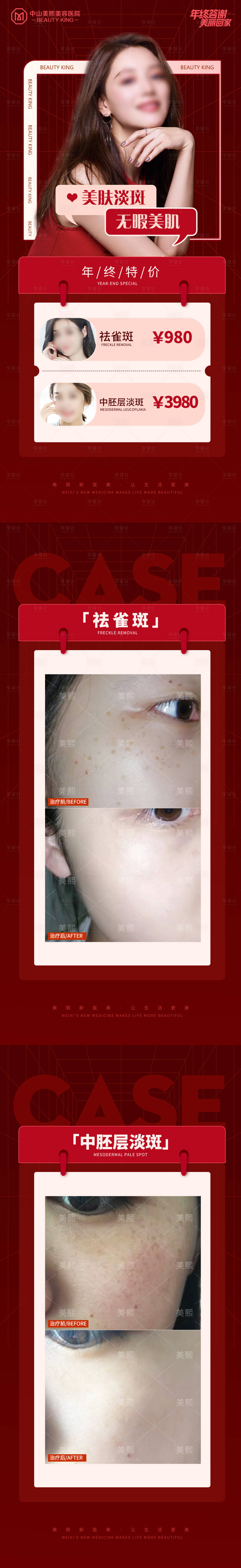 源文件下载【享设计】搜索编号：19920021903551121【新年淡斑活动价格海报】
