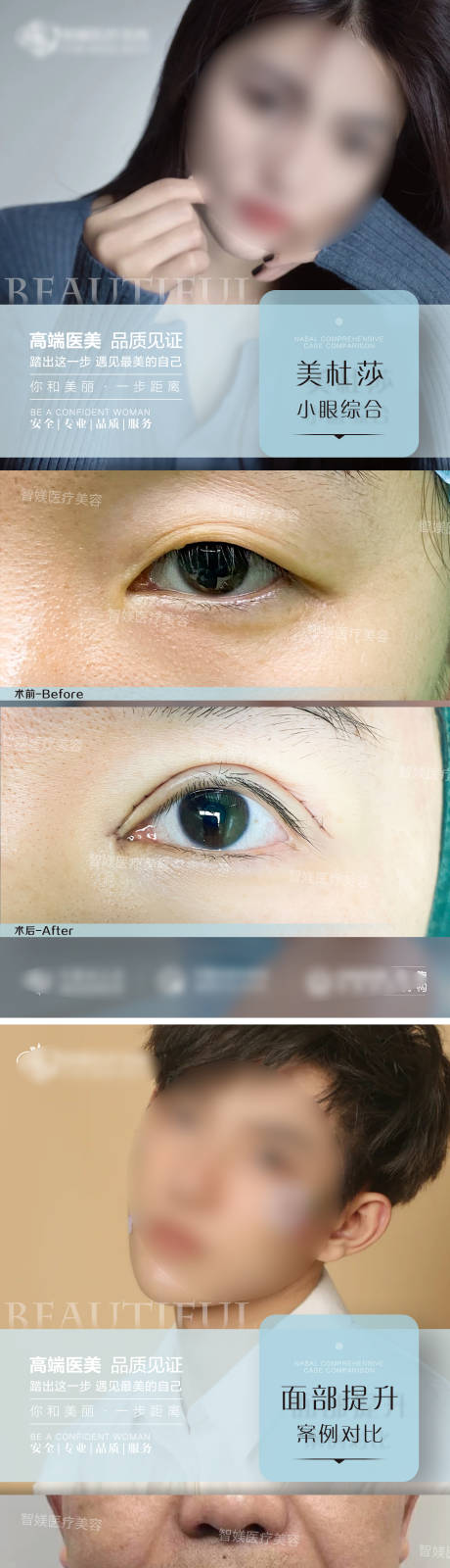 源文件下載【享設計】搜索編號：57470021978548043【整形案例模板海報】
