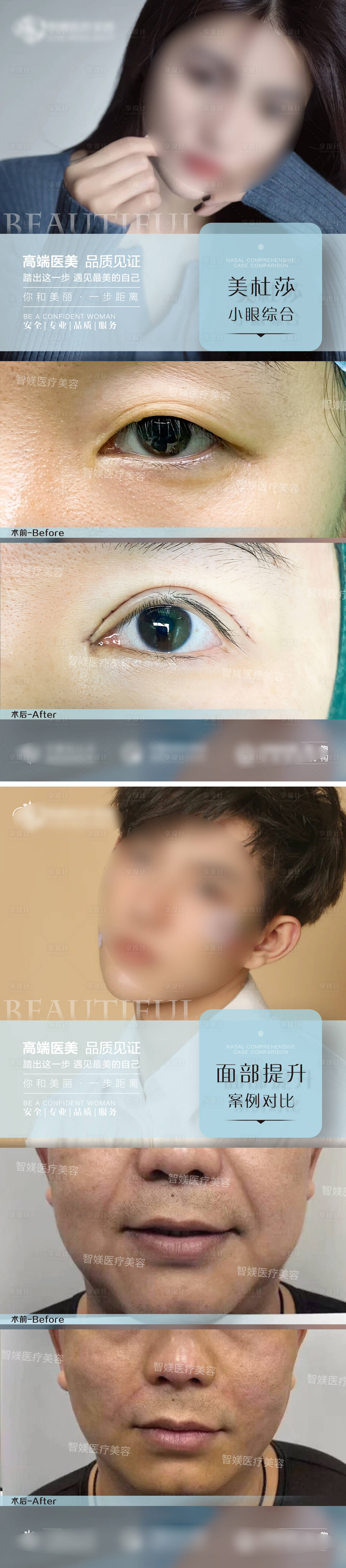 源文件下载【享设计】搜索编号：57470021978548043【整形案例模板海报】