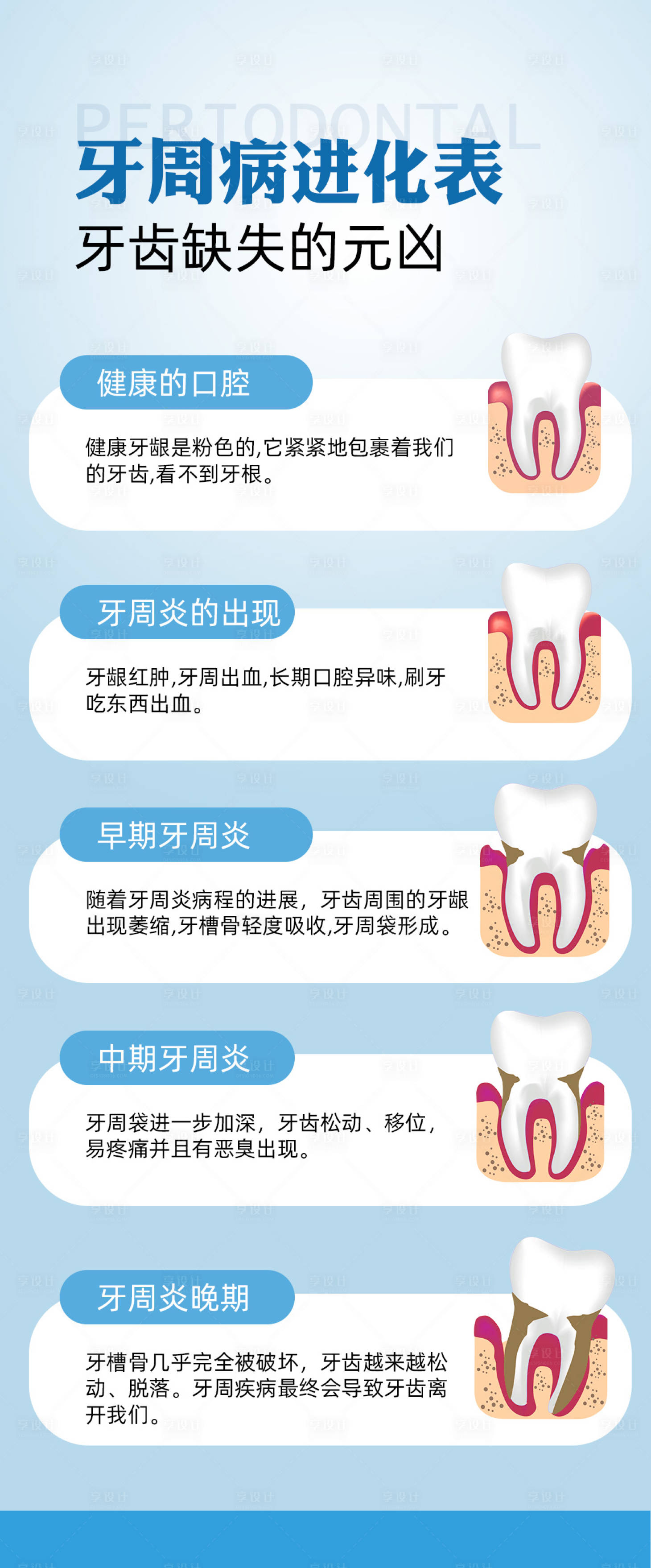 源文件下载【牙周病牙周炎】编号：70820022182838497