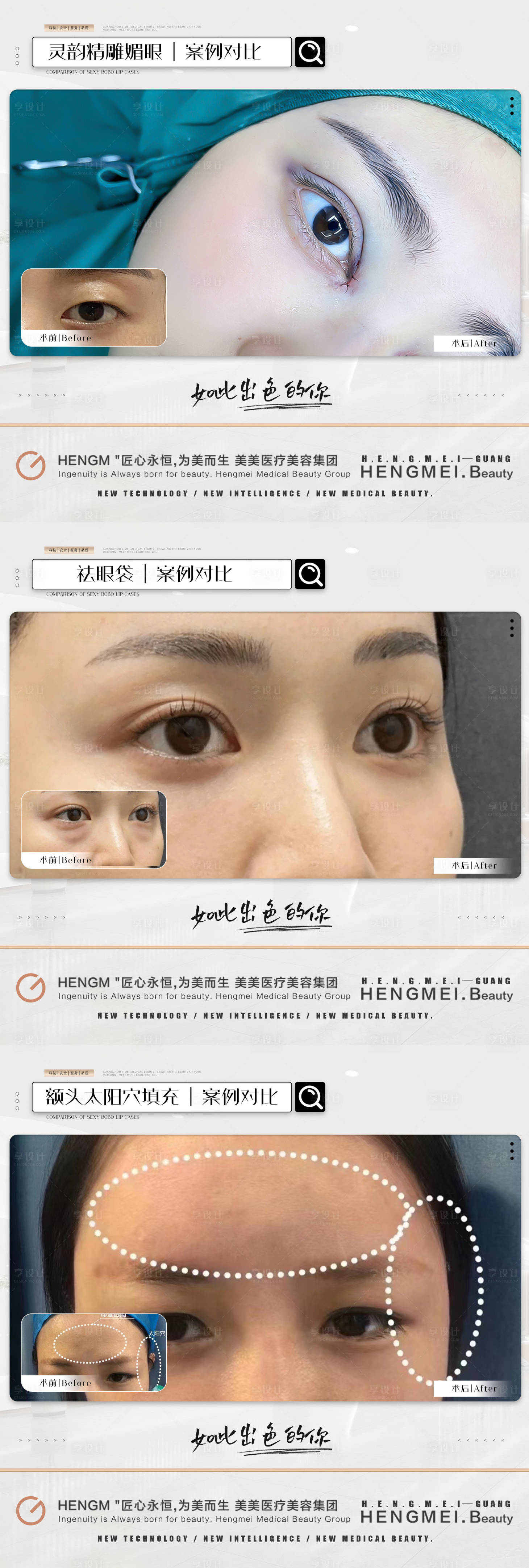 源文件下载【医美整形案例简约系列海报】编号：92560022020949091