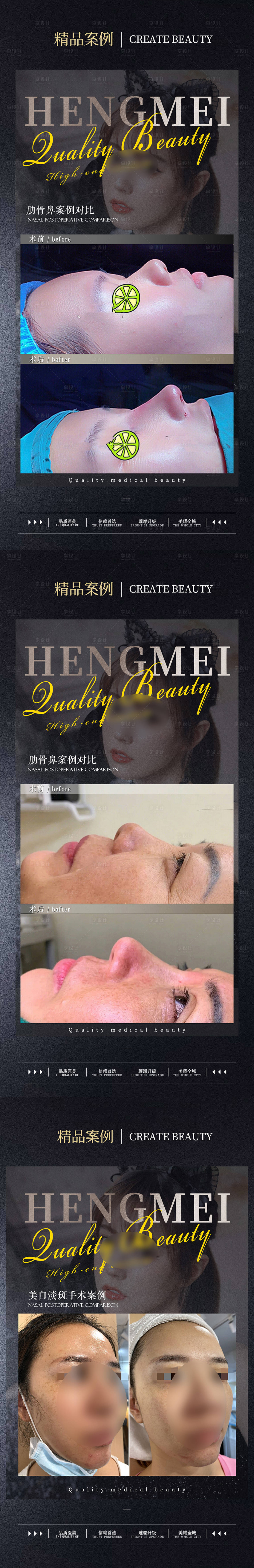 源文件下载【医美海报】编号：52510022067231462