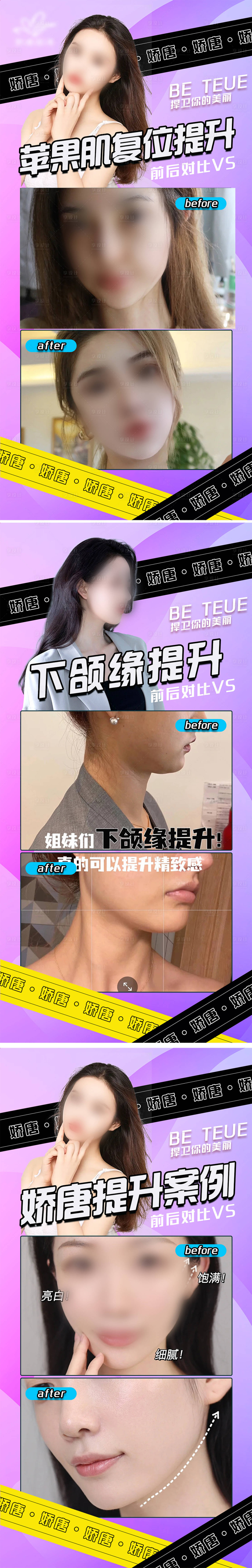 源文件下載【醫美案例展示海報】編號：60540022078393743
