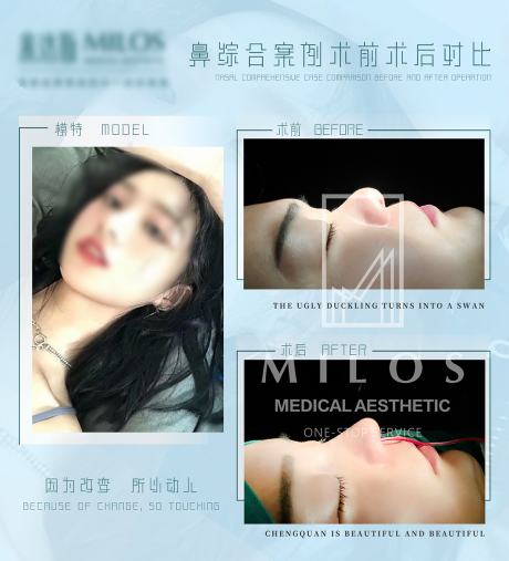 源文件下載【享設(shè)計(jì)】搜索編號：49450022081581935【整形案例海報(bào)】