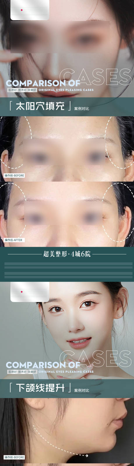 源文件下载【医美海报】编号：78530022199828635
