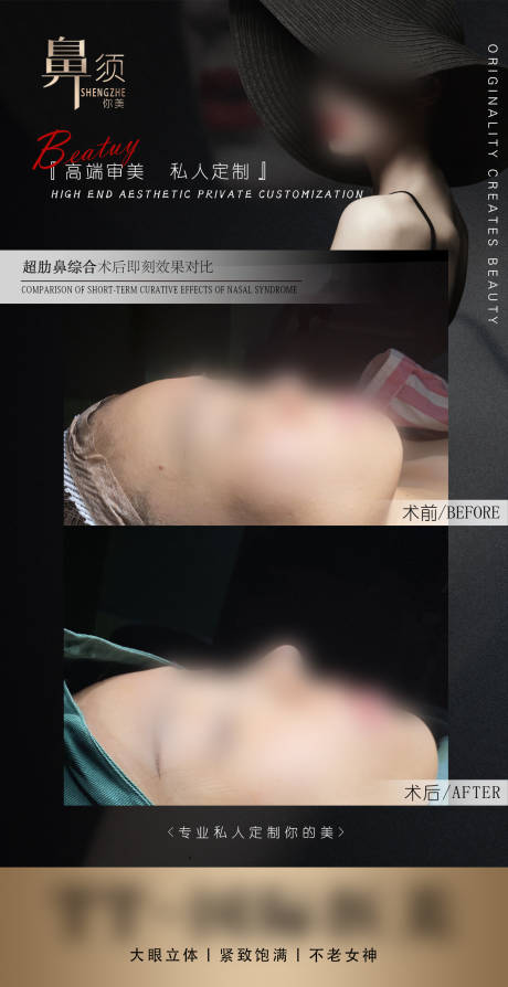 源文件下载【医美鼻综合案例对比简约海报】编号：26780022080849662