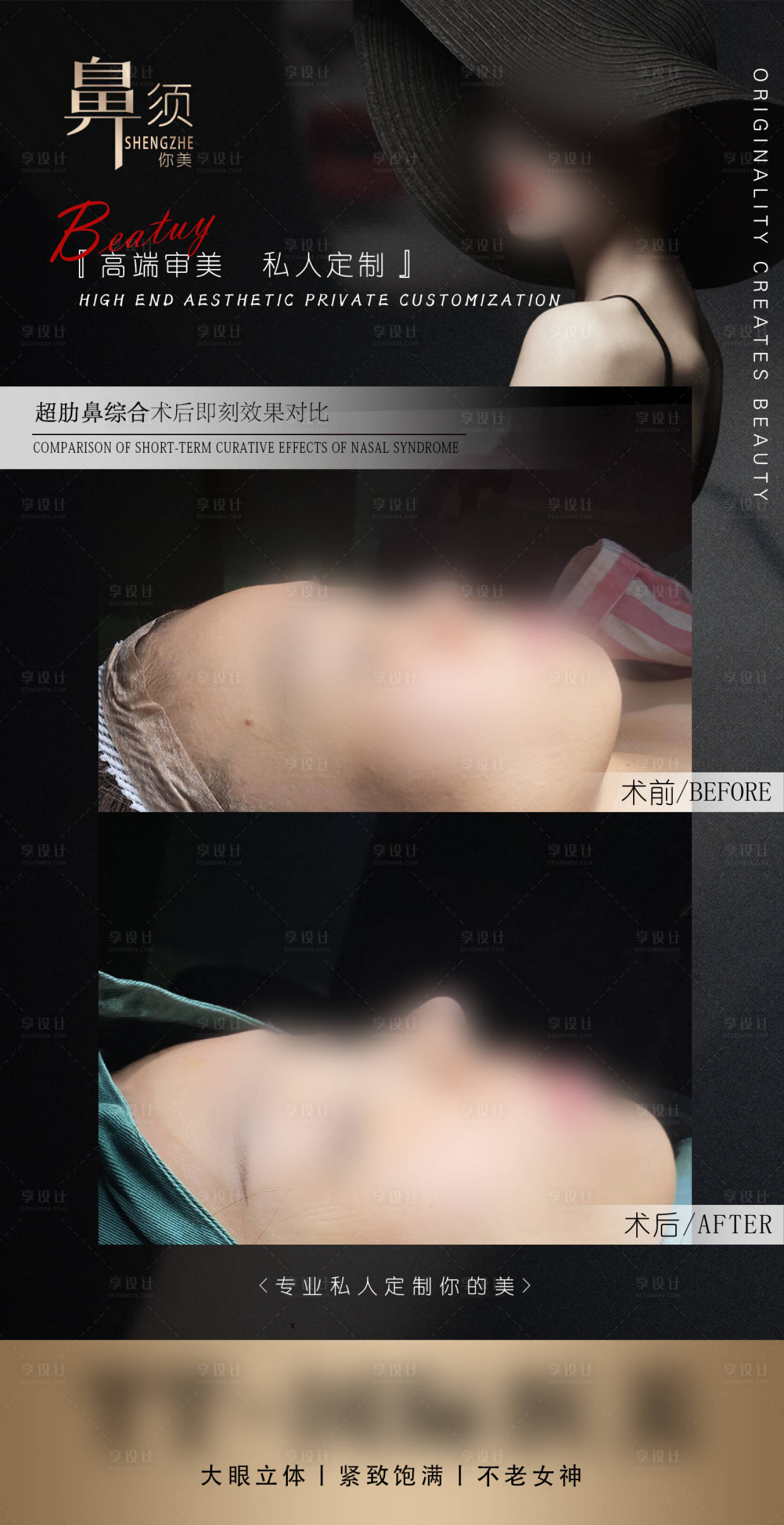 源文件下載【享設計】搜索編號：26780022080849662【醫美鼻綜合案例對比簡約海報】